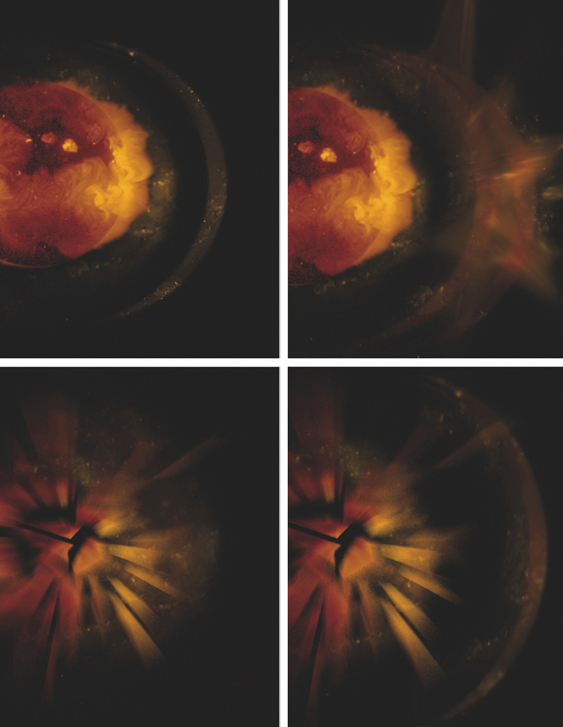 Scenes from a Supernova